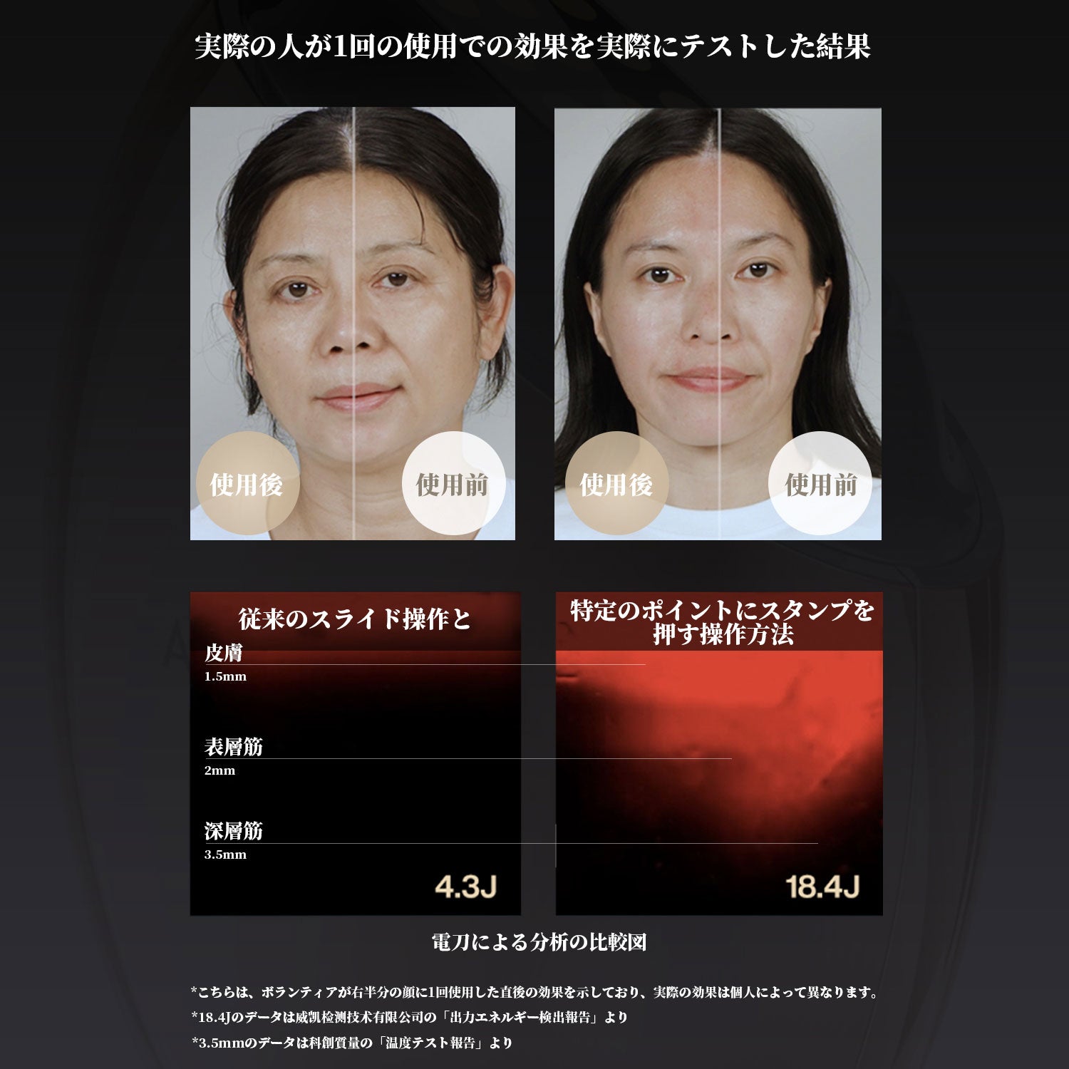 RF美顔器 AMIRO S1