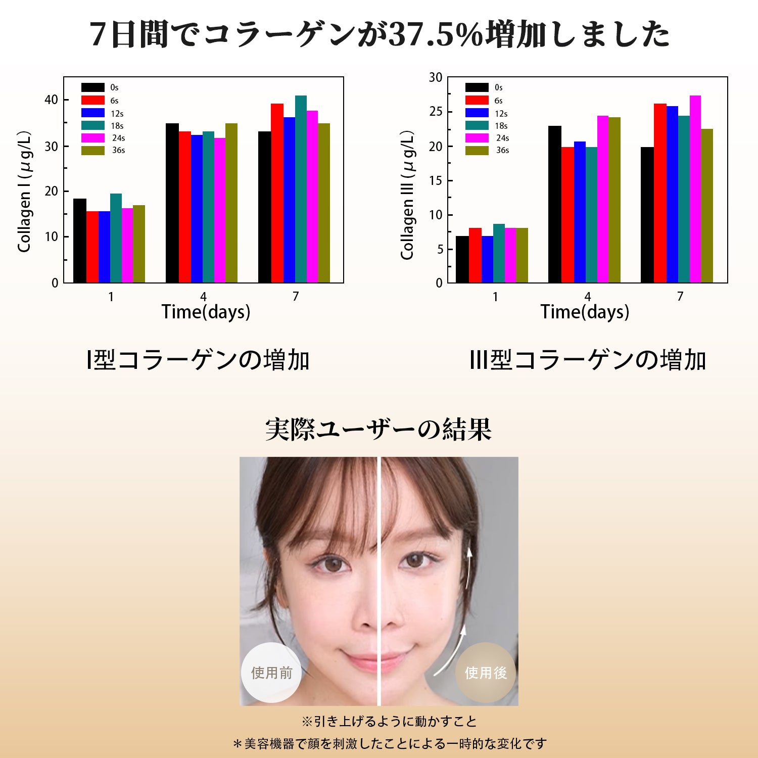 RF美顔器 AMIRO R3 Turbo