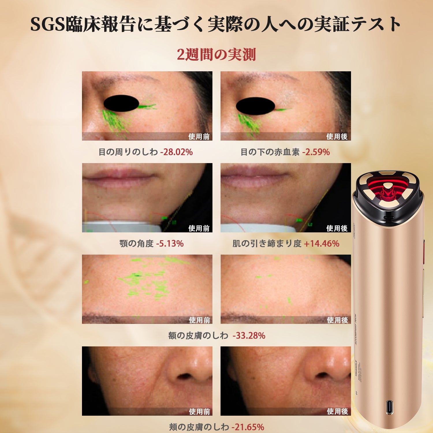 RF美顔器 AMIRO R3 Turbo