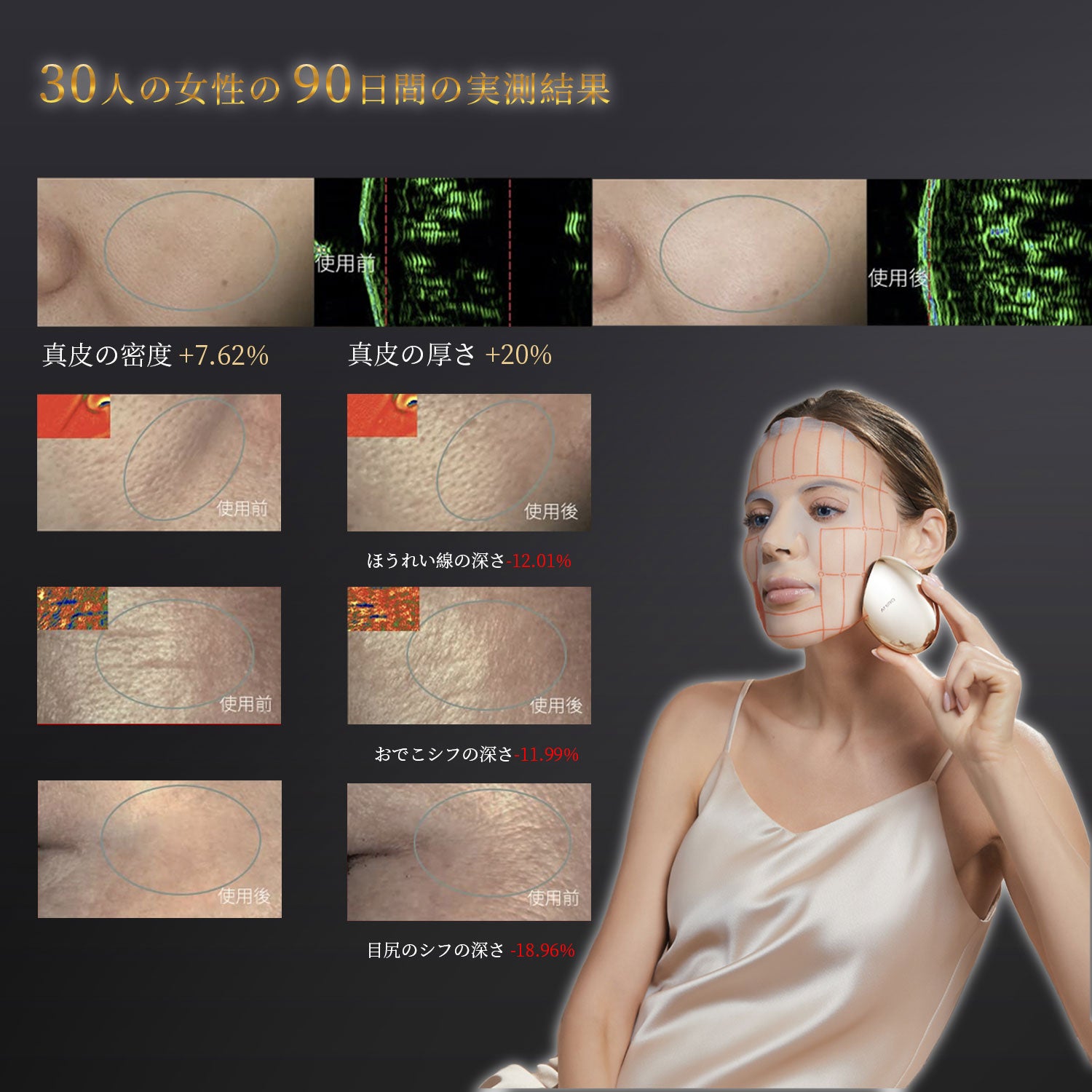 RF美顔器 AMIRO S1